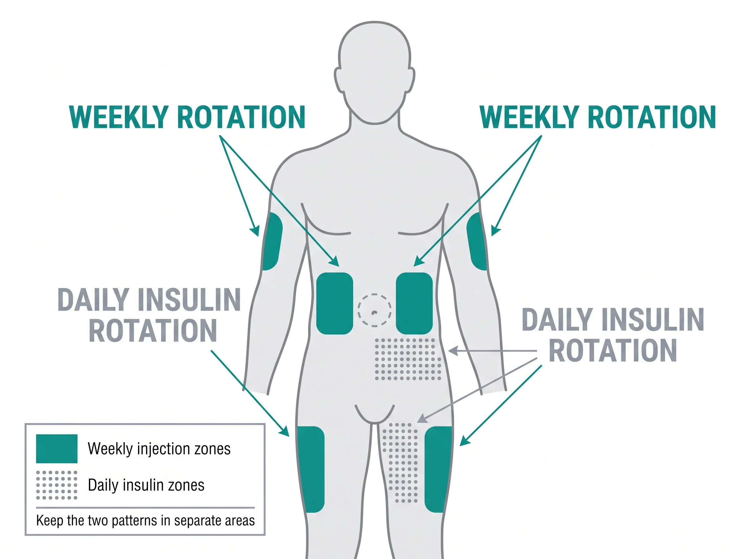 Body map showing weekly Mounjaro injection zones kept separate from denser daily insulin rotation zones.