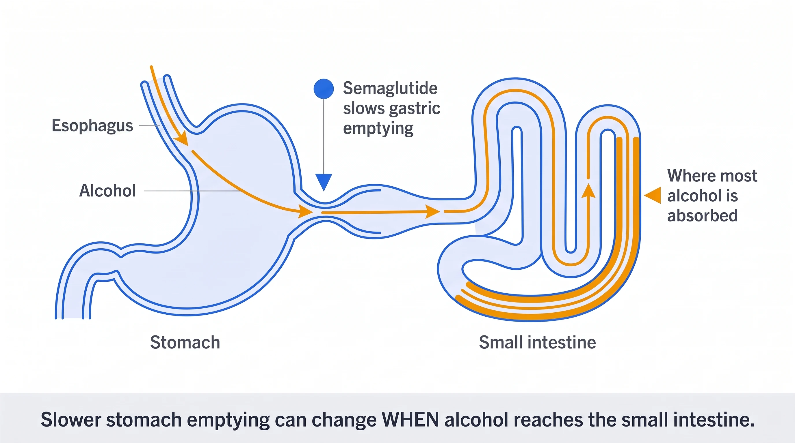 Diagram showing semaglutide slowing gastric emptying so alcohol reaches the small intestine more slowly.